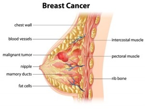 Mammography testing for early detection of breast cancer Breast cancer mammograms michigan